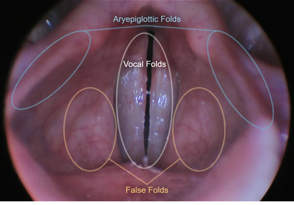 Larynx labelled screaming 101 - screaming anatomy 101 1